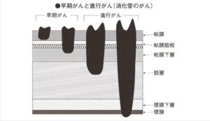 滝沢カレンの母親はガンって本当 画像が美人 芸能 スポーツ地獄耳